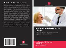 Bookcover of Métodos de deteção de cáries