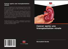 Couverture de Cancer après une transplantation rénale