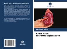 Buchcover von Krebs nach Nierentransplantation