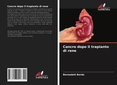 Portada del libro de Cancro dopo il trapianto di rene