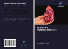 Bookcover of Kanker na niertransplantatie