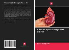 Обложка Câncer após transplante de rim