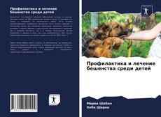 Buchcover von Профилактика и лечение бешенства среди детей