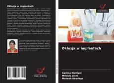 Okluzja w implantach kitap kapağı