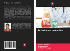 Обложка Oclusão em Implantes