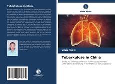 Обложка Tuberkulose in China