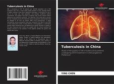 Buchcover von Tuberculosis in China