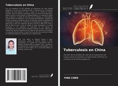 Capa do livro de Tuberculosis en China 
