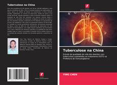 Copertina di Tuberculose na China