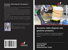 Copertina di Bruxismo: dalla diagnosi alla gestione protesica