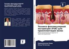 Couverture de Техника фолликулярной экстракции (FUE) для трансплантации волос