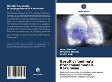 Buchcover von Beruflich bedingte bronchopulmonale Karzinome