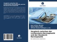 Vergleich zwischen der Lichtenstein-Hernioplastik und der Bendavid-Hernioplastik kitap kapağı