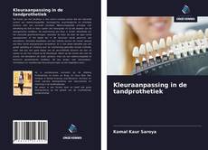 Bookcover of Kleuraanpassing in de tandprothetiek