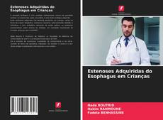 Bookcover of Estenoses Adquiridas do Esophagus em Crianças