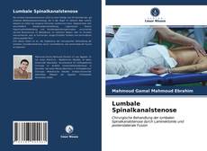 Capa do livro de Lumbale Spinalkanalstenose 