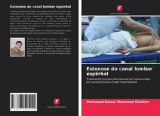 Bookcover of Estenose do canal lombar espinhal