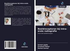 Bookcover of Beeldreceptoren bij Intra-orale radiografie