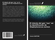 Bookcover of El interés del gen "nuc" en la identificación de Staphylococcus aureus