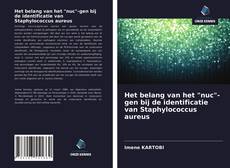 Bookcover of Het belang van het "nuc"-gen bij de identificatie van Staphylococcus aureus