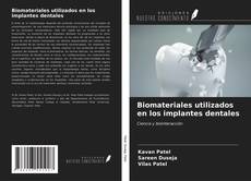 Copertina di Biomateriales utilizados en los implantes dentales