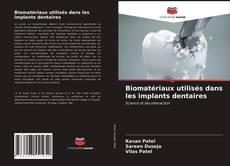 Biomatériaux utilisés dans les implants dentaires kitap kapağı