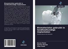 Bookcover of Biomaterialen gebruikt in tandheelkundige implantaten