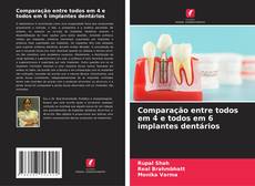 Borítókép a  Comparação entre todos em 4 e todos em 6 implantes dentários - hoz