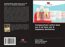 Bookcover of Comparaison entre tous sur 4 et tous sur 6 implants dentaires