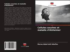 Cellules souches et maladie d'Alzheimer kitap kapağı