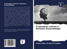 Buchcover von Стволовые клетки и болезнь Альцгеймера