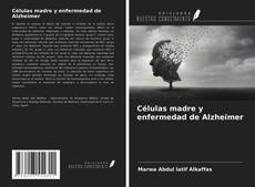 Copertina di Células madre y enfermedad de Alzheimer