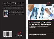 Bookcover of Sygnalizacja NOTCH jako nowy cel dla nowotworów