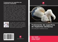 Copertina di Tratamento de superfície de implantes dentários