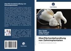 Copertina di Oberflächenbehandlung von Zahnimplantaten