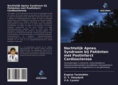 Bookcover of Nachtelijk Apneu Syndroom bij Patiënten met Postinfarct Cardiosclerose