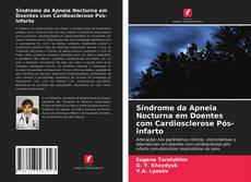 Couverture de Síndrome da Apneia Nocturna em Doentes com Cardiosclerose Pós-infarto