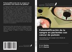 Couverture de Fotomodificación de la sangre en pacientes con cáncer de pulmón