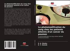 Buchcover von La photomodification du sang chez les patients atteints d'un cancer du poumon