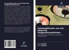 Bookcover of Fotomodificatie van het bloed bij longkankerpatiënten