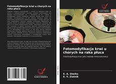 Bookcover of Fotomodyfikacja krwi u chorych na raka płuca