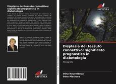 Copertina di Displasia del tessuto connettivo: significato prognostico in diabetologia