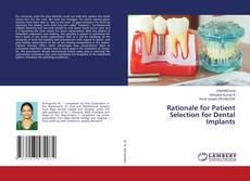 Copertina di Rationale for Patient Selection for Dental Implants