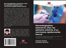 Dermatoglyphes palmaires chez les patients atteints d'un carcinome épidermoïde buccal的封面