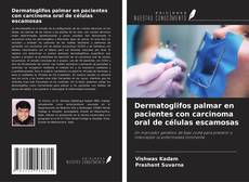 Copertina di Dermatoglifos palmar en pacientes con carcinoma oral de células escamosas