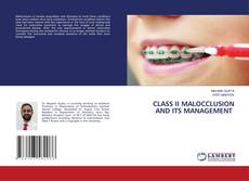 Copertina di CLASS II MALOCCLUSION AND ITS MANAGEMENT