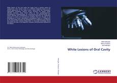 Copertina di White Lesions of Oral Cavity
