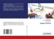Copertina di Implant Failure
