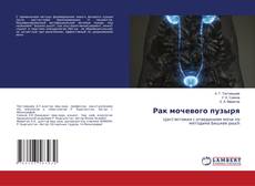 Copertina di Рак мочевого пузыря