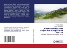 Copertina di Воронкообразная деформация грудной клетки